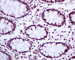 Immunohistochemistry (Formalin/PFA-fixed paraffin-embedded sections) - Anti-Tat-SF1 antibody [EPR9105(B)] (AB134921)