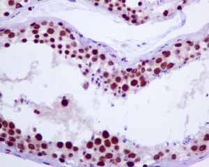 Immunohistochemistry (Formalin/PFA-fixed paraffin-embedded sections) - Anti-Tat-SF1 antibody [EPR9105(B)] (AB134921), expandable thumbnail