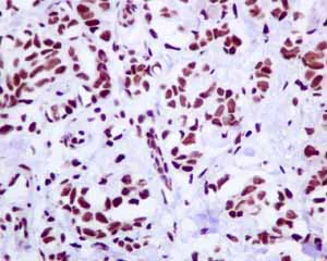 Immunohistochemistry (Formalin/PFA-fixed paraffin-embedded sections) - Anti-Tat-SF1 antibody [EPR9105(B)] (AB134921)