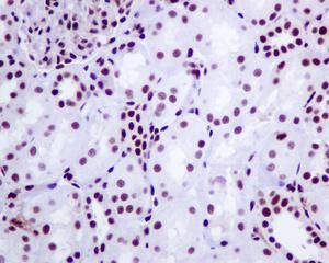 Immunohistochemistry (Formalin/PFA-fixed paraffin-embedded sections) - Anti-Tat-SF1 antibody [EPR9105(B)] (AB134921), expandable thumbnail
