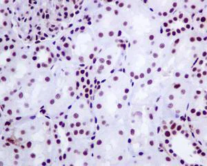 Immunohistochemistry (Formalin/PFA-fixed paraffin-embedded sections) - Anti-Tat-SF1 antibody [EPR9105(B)] (AB134921)