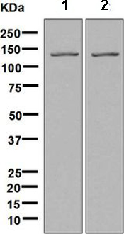 Western blot - Anti-Tat-SF1 antibody [EPR9105(B)] (AB134921), expandable thumbnail