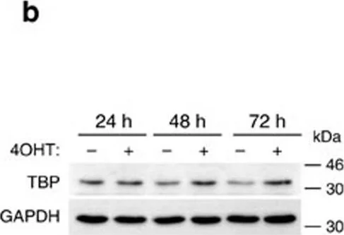 Western blot - Anti-TATA binding protein TBP antibody [1TBP18] - Loading Control and ChIP Grade (AB818)