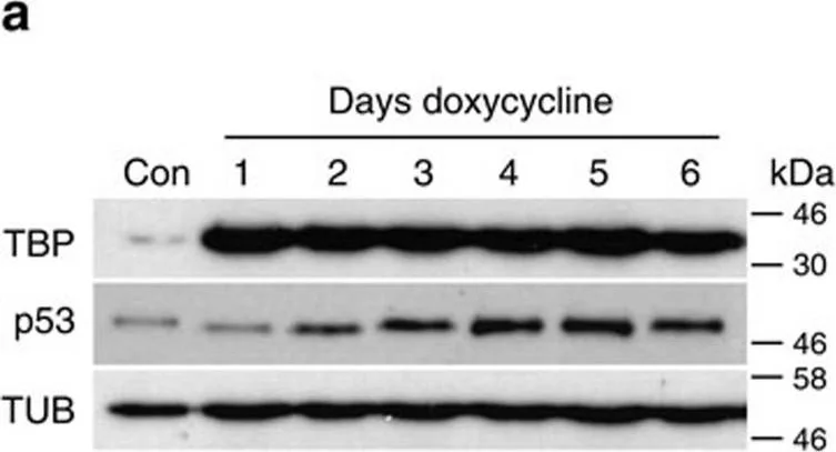 Western blot - Anti-TATA binding protein TBP antibody [1TBP18] - Loading Control and ChIP Grade (AB818)