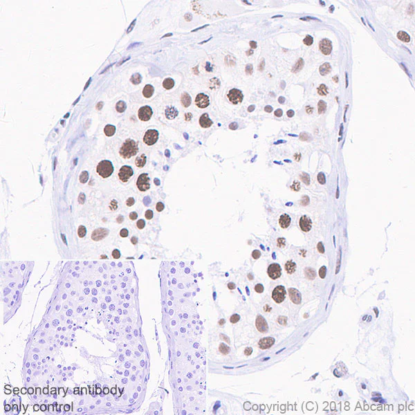 Immunohistochemistry (Formalin/PFA-fixed paraffin-embedded sections) - Anti-TATA binding protein TBP antibody [EPR21954] - ChIP Grade - BSA and Azide free (AB237785)