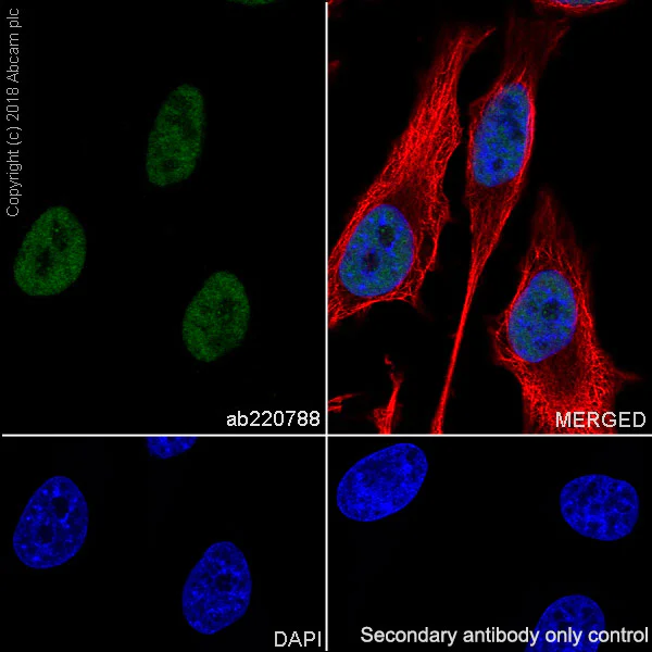 Immunocytochemistry/ Immunofluorescence - Anti-TATA binding protein TBP antibody [EPR21954] - Loading Control and ChIP Grade (AB220788)