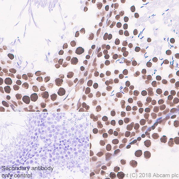 Immunohistochemistry (Formalin/PFA-fixed paraffin-embedded sections) - Anti-TATA binding protein TBP antibody [EPR21954] - ChIP Grade (ab220788), expandable thumbnail