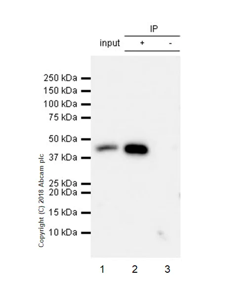 Immunoprecipitation - Anti-TATA binding protein TBP antibody [EPR21954] - Loading Control and ChIP Grade (AB220788)