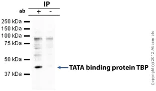 Immunoprecipitation - Anti-TATA binding protein TBP antibody - Nuclear Loading Control and ChIP Grade (AB63766)