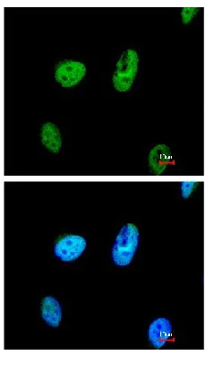 Immunocytochemistry/ Immunofluorescence - Anti-TATDN1 antibody (AB97818)