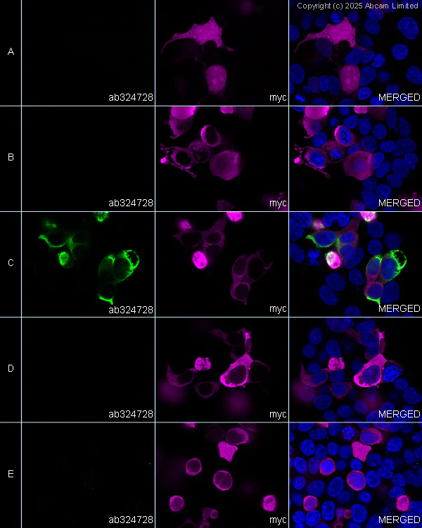 Immunocytochemistry/ Immunofluorescence - Anti-Tau (acetyl K311) antibody [EPR29545-504] (AB324728)