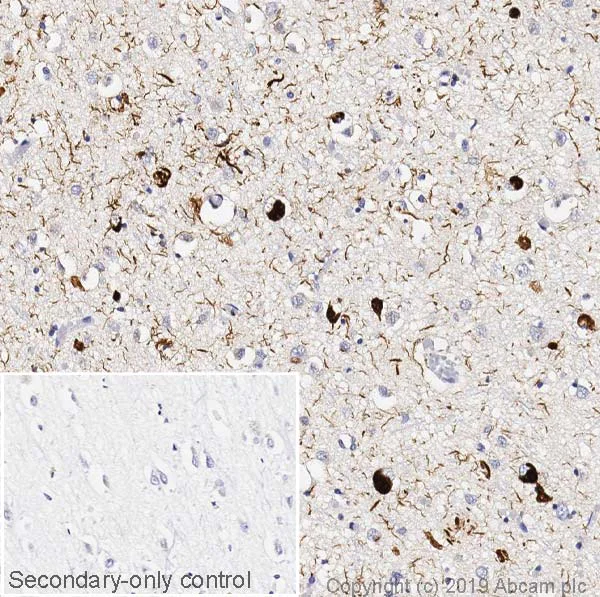 Immunohistochemistry (Formalin/PFA-fixed paraffin-embedded sections) - Anti-Tau Alzheimer’s Disease antibody [GT-38] - Conformation-Specific (AB246808)