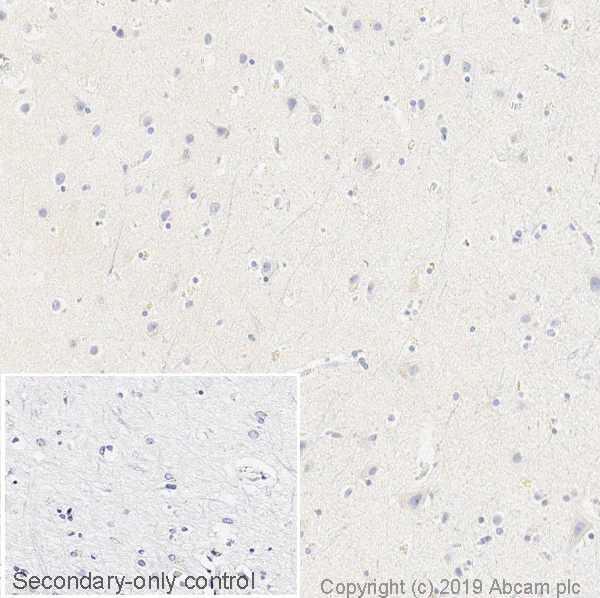 Immunohistochemistry (Formalin/PFA-fixed paraffin-embedded sections) - Anti-Tau Alzheimer’s Disease antibody [GT-38] - Conformation-Specific - BSA and Azide free (AB254274)