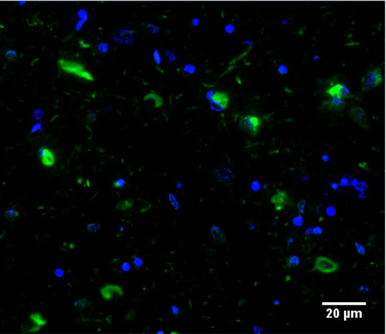 Immunohistochemistry paraffin embedded sections - Anti-Tau Alzheimer’s Disease antibody [GT-38] - Conformation-Specific - BSA and Azide free (AB254274)