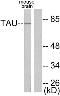 Western blot - Anti-Tau antibody (AB47579)