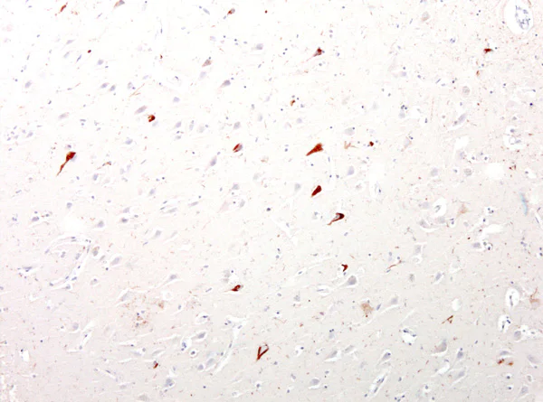 Immunohistochemistry (Formalin/PFA-fixed paraffin-embedded sections) - Anti-Tau antibody (AB75714)