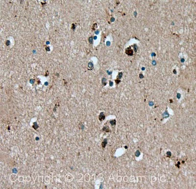Immunohistochemistry (Formalin/PFA-fixed paraffin-embedded sections) - Anti-Tau antibody (AB75714)
