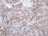 Immunohistochemistry (Formalin/PFA-fixed paraffin-embedded sections) - Anti-Tau antibody (AB97778), expandable thumbnail