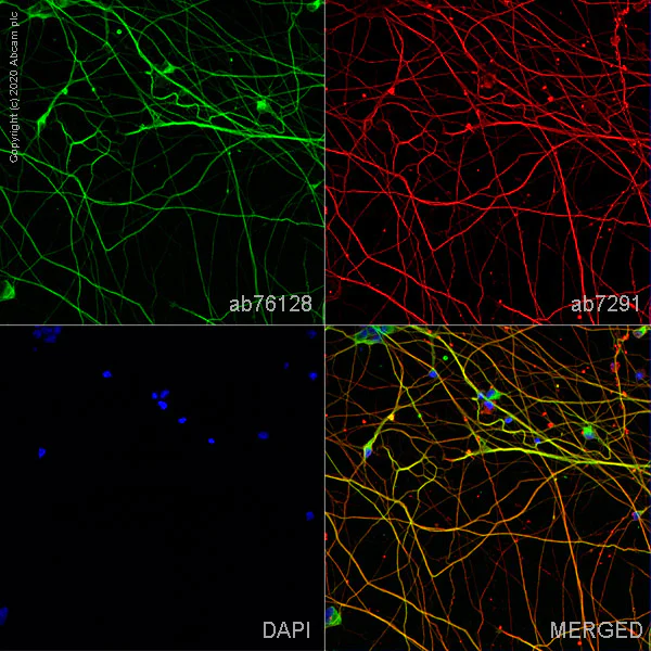 TAU様確認ページ Anti-Tau antibody [EP2456Y] 20 ul size (ab76128) | Abcam