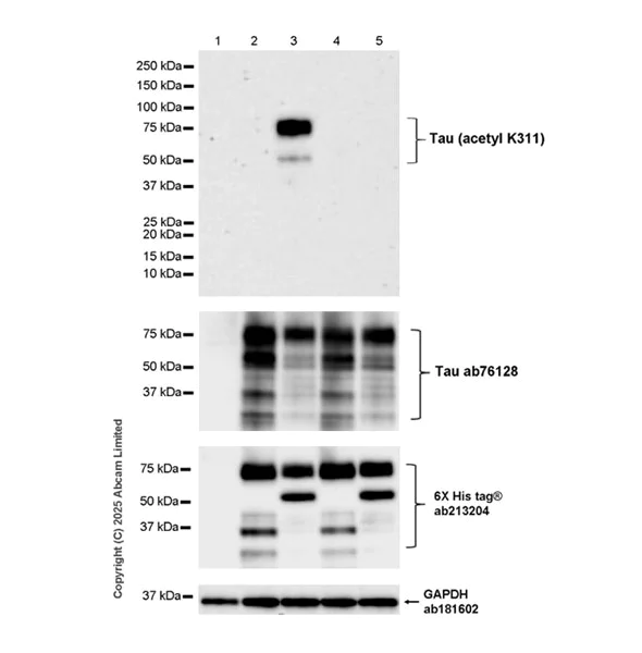 Western blot - Anti-Tau antibody [EP2456Y] (AB76128)