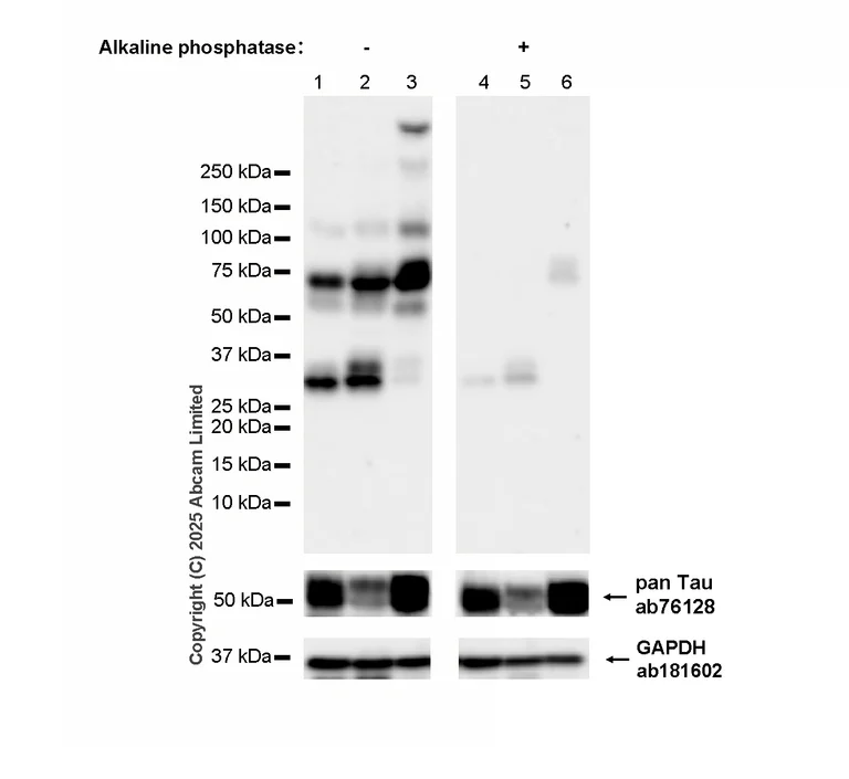 Western blot - Anti-Tau antibody [EP2456Y] (AB76128)