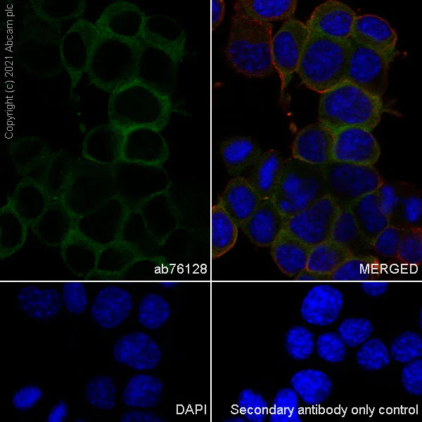 Immunocytochemistry/ Immunofluorescence - Anti-Tau antibody [EP2456Y] - BSA and Azide free (AB174727)