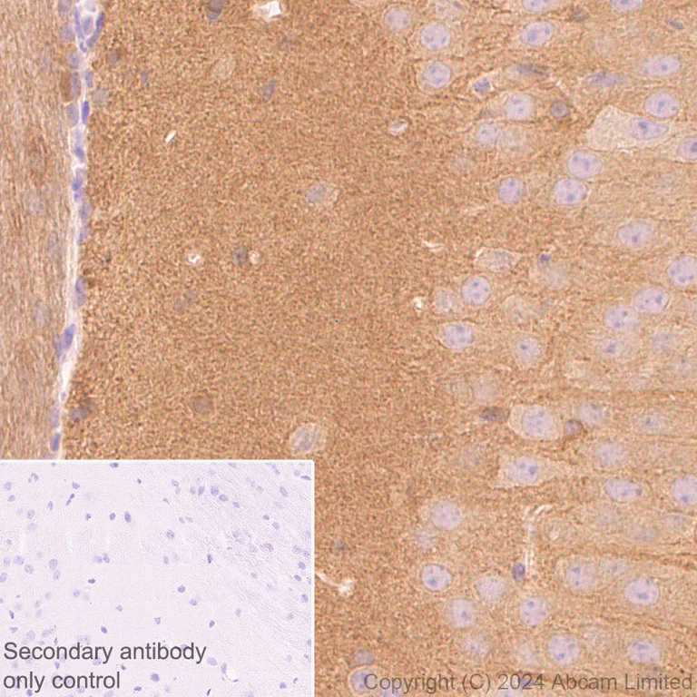 Immunohistochemistry (Formalin/PFA-fixed paraffin-embedded sections) - Anti-Tau antibody [EP2456Y] - BSA and Azide free (AB174727)