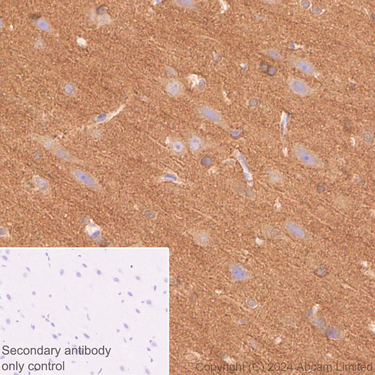 Immunohistochemistry (Formalin/PFA-fixed paraffin-embedded sections) - Anti-Tau antibody [EP2456Y] - BSA and Azide free (AB174727)