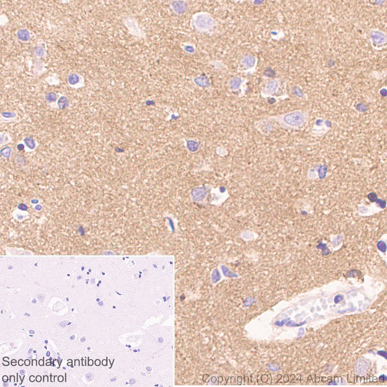 Immunohistochemistry (Formalin/PFA-fixed paraffin-embedded sections) - Anti-Tau antibody [EP2456Y] - BSA and Azide free (AB174727)