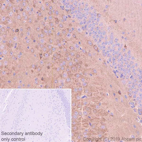 Immunohistochemistry (Formalin/PFA-fixed paraffin-embedded sections) - Anti-Tau antibody [EPR22524-95] (AB254256)