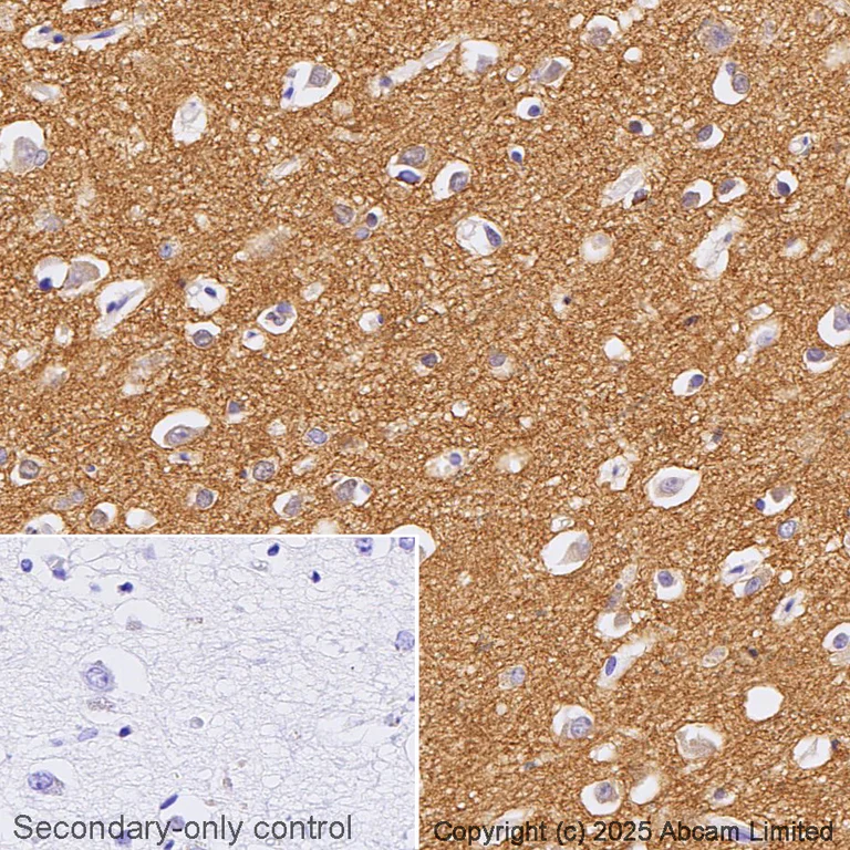 Immunohistochemistry (Formalin/PFA-fixed paraffin-embedded sections) - Anti-Tau antibody [EPR22524-95] (AB254256)