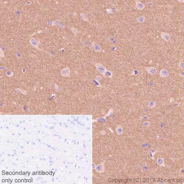 Immunohistochemistry (Formalin/PFA-fixed paraffin-embedded sections) - Anti-Tau antibody [EPR22524-95] (AB254256)