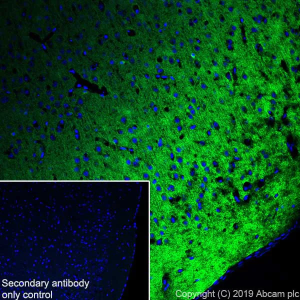 Immunohistochemistry (Frozen sections) - Anti-Tau antibody [EPR22524-95] (AB254256)