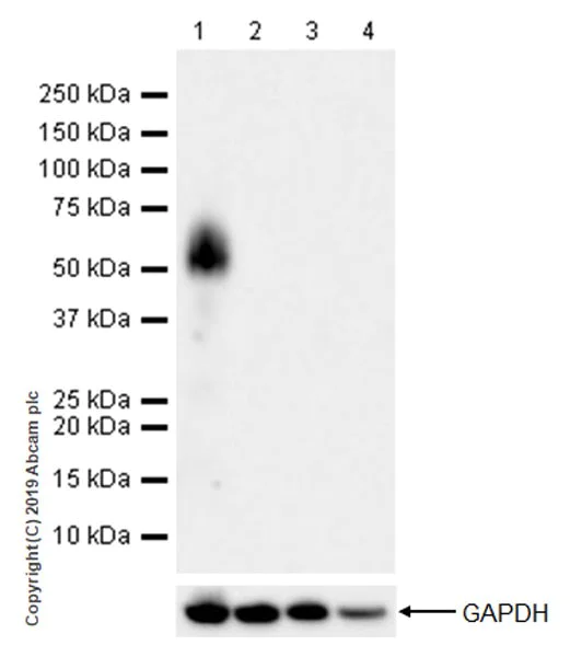 Western blot - Anti-Tau antibody [EPR22524-95] (AB254256)