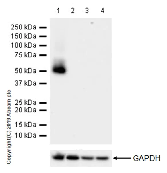 Western blot - Anti-Tau antibody [EPR22524-95] (AB254256)