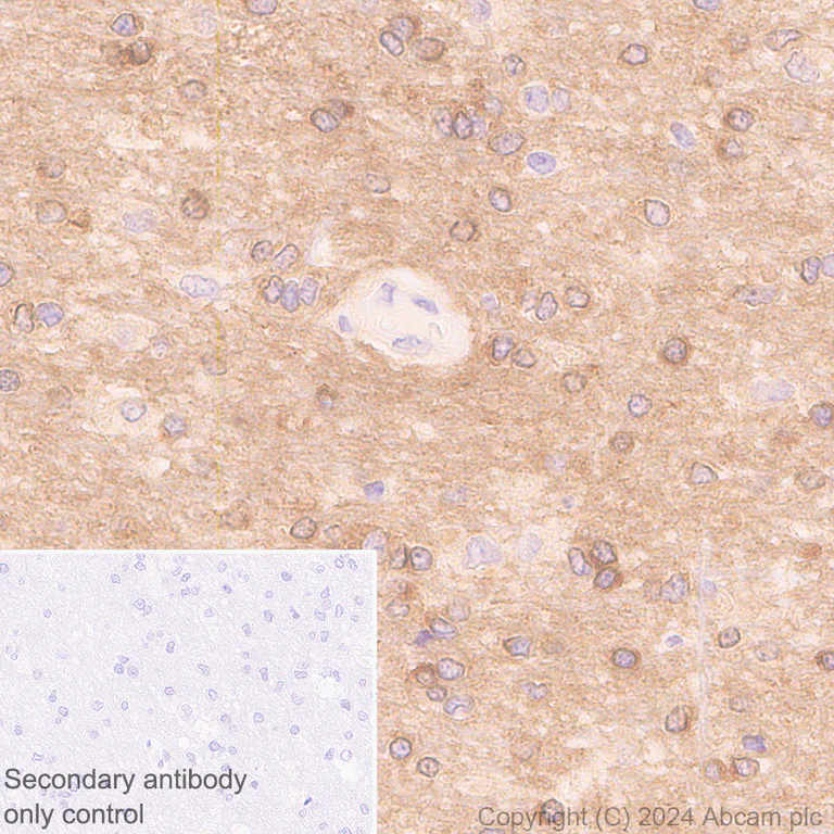 Immunohistochemistry (Formalin/PFA-fixed paraffin-embedded sections) - Anti-Tau antibody [EPR22524-95] - Mouse IgG1 (Chimeric) (AB317841)
