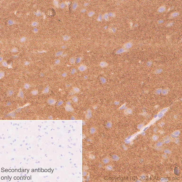 Immunohistochemistry (Formalin/PFA-fixed paraffin-embedded sections) - Anti-Tau antibody [EPR22524-95] - Mouse IgG1 (Chimeric) (AB317841)