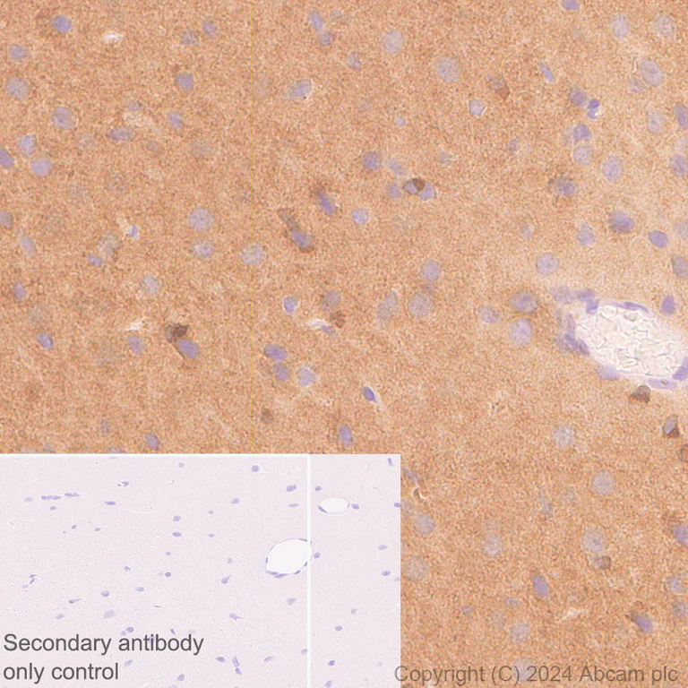 Immunohistochemistry (Formalin/PFA-fixed paraffin-embedded sections) - Anti-Tau antibody [EPR22524-95] - Mouse IgG1 (Chimeric) (AB317841)