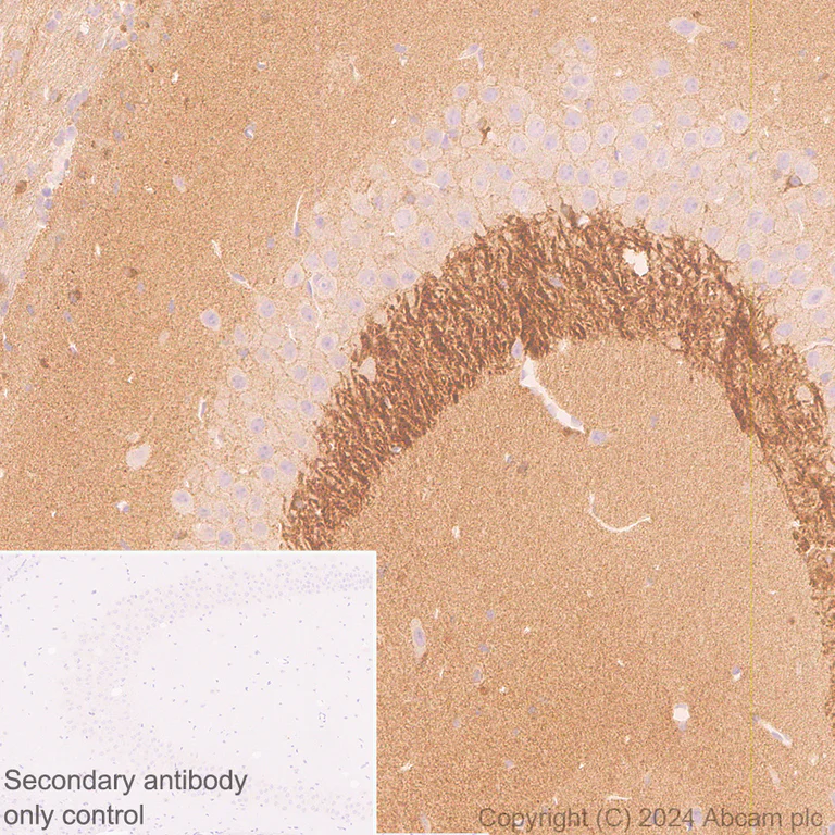 Immunohistochemistry (Formalin/PFA-fixed paraffin-embedded sections) - Anti-Tau antibody [EPR22524-95] - Mouse IgG1 (Chimeric) (AB317841)