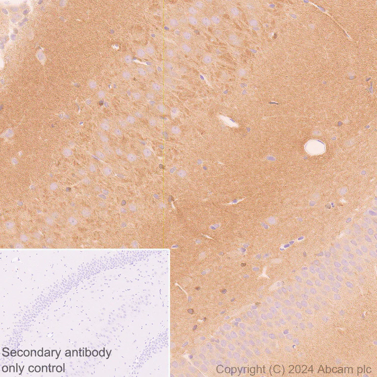 Immunohistochemistry (Formalin/PFA-fixed paraffin-embedded sections) - Anti-Tau antibody [EPR22524-95] - Mouse IgG1 (Chimeric) (AB317841)