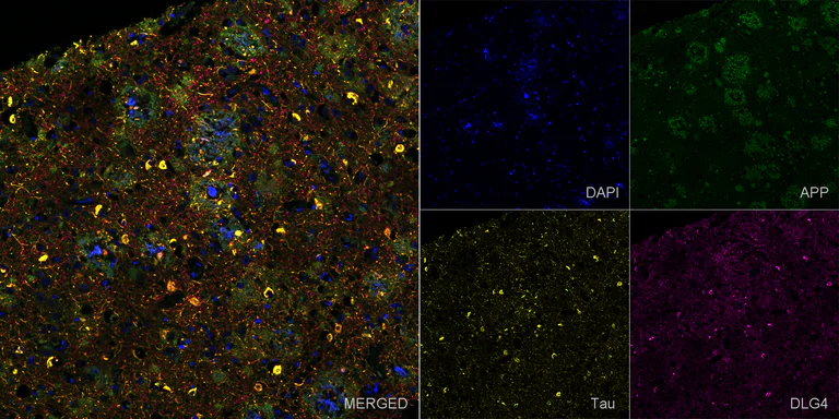 Immunohistochemistry (Formalin/PFA-fixed paraffin-embedded sections) - Anti-Tau antibody [EPR22524-95] - Mouse IgG1 (Chimeric) (AB317841)