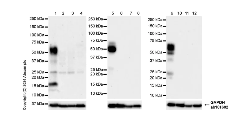 Western blot - Anti-Tau antibody [EPR22524-95] - Mouse IgG1 (Chimeric) - BSA and Azide free (AB317842)