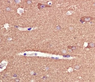 Immunohistochemistry (Formalin/PFA-fixed paraffin-embedded sections) - Anti-Tau antibody [EPR2396(2)] - BSA and Azide free (AB244231)