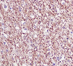 Immunohistochemistry (Formalin/PFA-fixed paraffin-embedded sections) - Anti-Tau antibody [EPR2396(2)] - BSA and Azide free (AB244231)