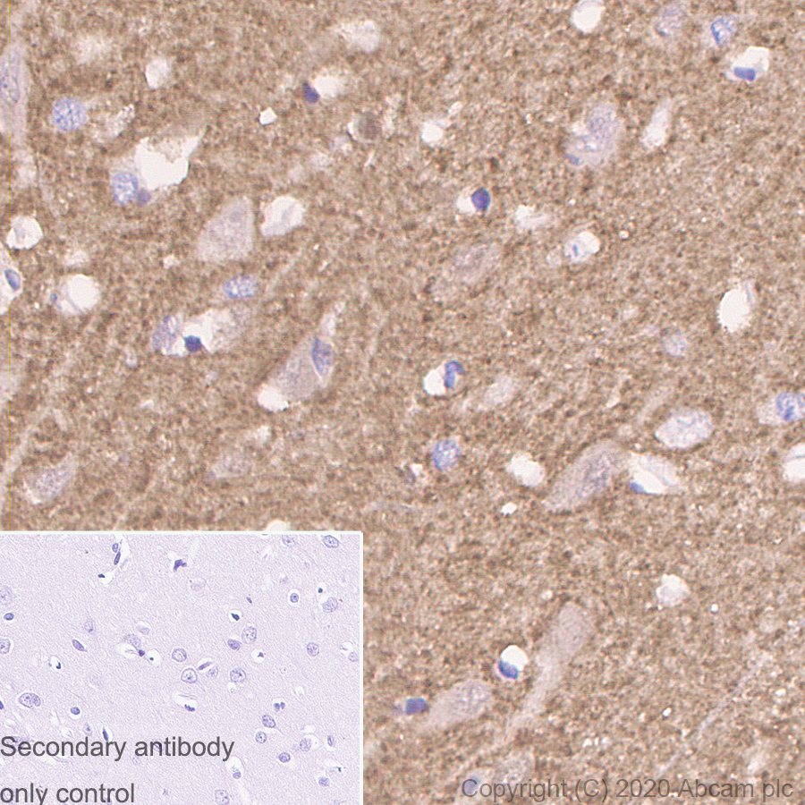 Immunohistochemistry (Formalin/PFA-fixed paraffin-embedded sections) - Anti-Tau antibody [PC1C6] (AB254150)