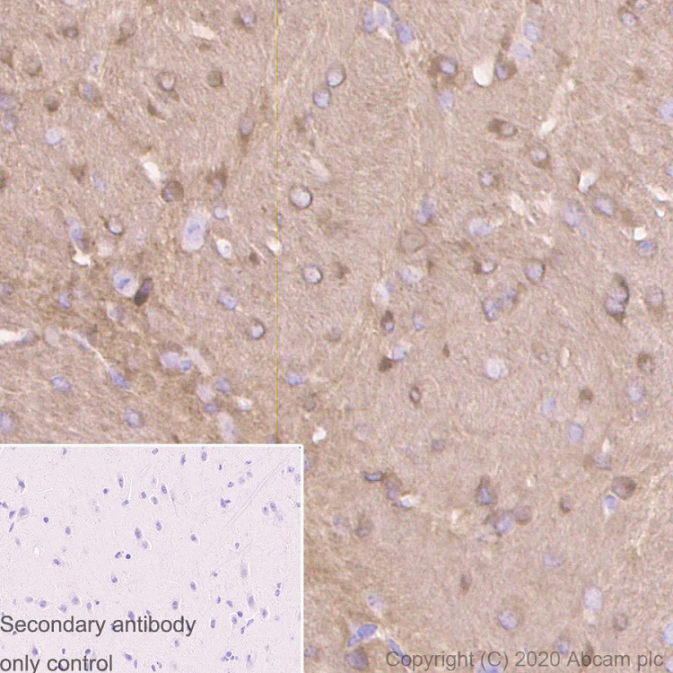 Immunohistochemistry (Formalin/PFA-fixed paraffin-embedded sections) - Anti-Tau antibody [PC1C6] - BSA and Azide free (AB255907)