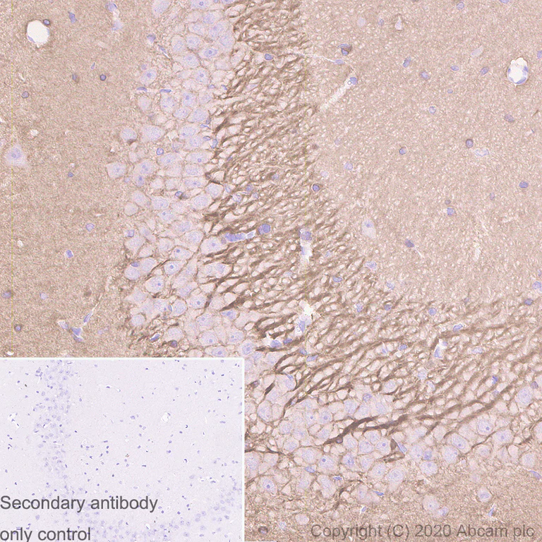 Immunohistochemistry (Formalin/PFA-fixed paraffin-embedded sections) - Anti-Tau antibody [PC1C6] - BSA and Azide free (AB255907)