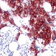 Immunohistochemistry (Formalin/PFA-fixed paraffin-embedded sections) - Anti-Tau antibody [SP70] (AB93726)