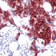 Immunohistochemistry (Formalin/PFA-fixed paraffin-embedded sections) - Anti-Tau antibody [SP70] - BSA and Azide free (AB236219)