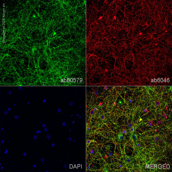 Immunocytochemistry/ Immunofluorescence - Anti-Tau antibody [TAU-5] - BSA and Azide free (AB80579)